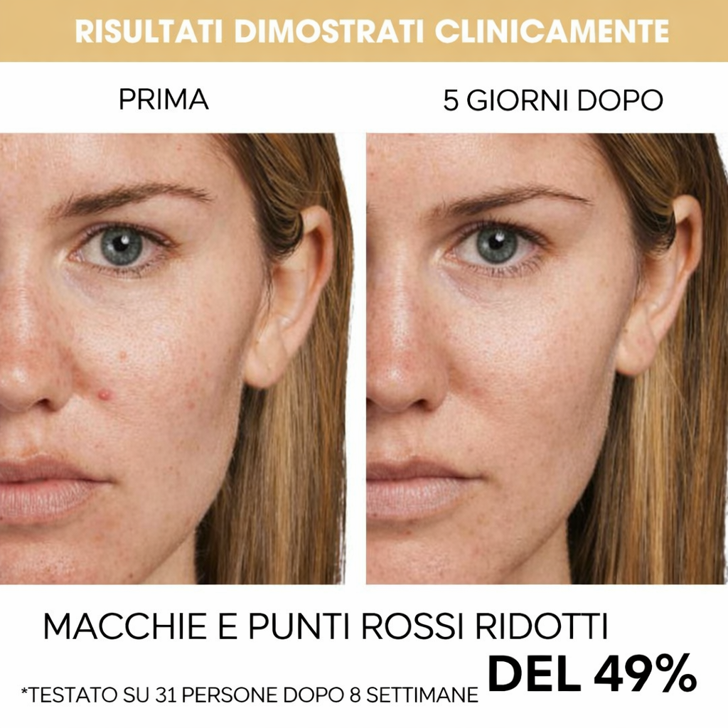 Princily | Capsule di Vitamina C - Radianza senza pari!
